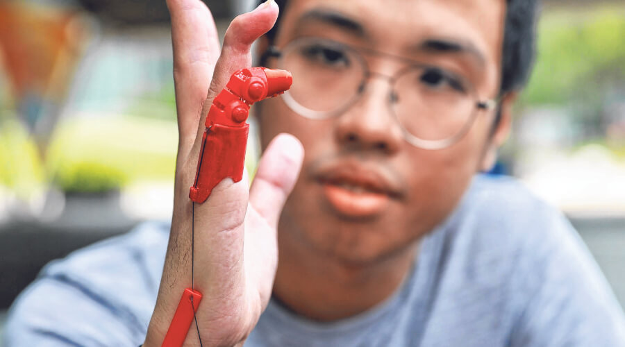 Engineering student gets 3D printed finger after bike accident Tan